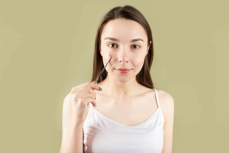 Acne Scarring vs. PIH vs. PIE: Understanding the Differences and Treatments